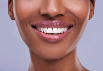 Woman smiling after cosmetic bonding treatment at Martin Periodontics in Mason, OH