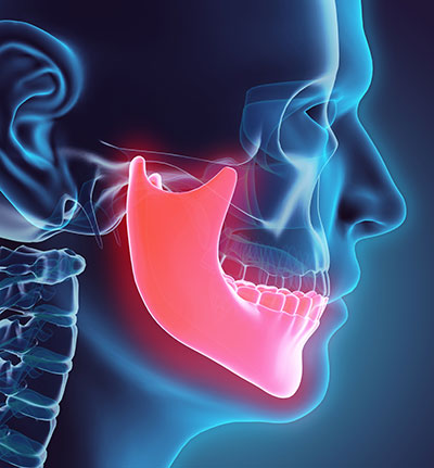 Image of a human jaw at Martin Periodontics in Mason, OH.