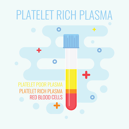 Platelet-Rich Plasma Treatment at Martin Periodontics in Mason and North Cincinnati, OH