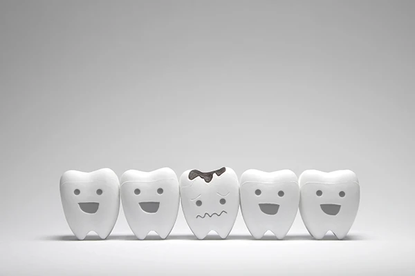 Row of five toy teeth, all smiling except for the middle tooth which frowns because of tooth decay.