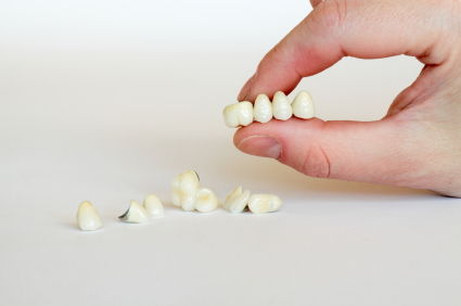Image of a dental bridge held in hand, at Martin Periodontics.